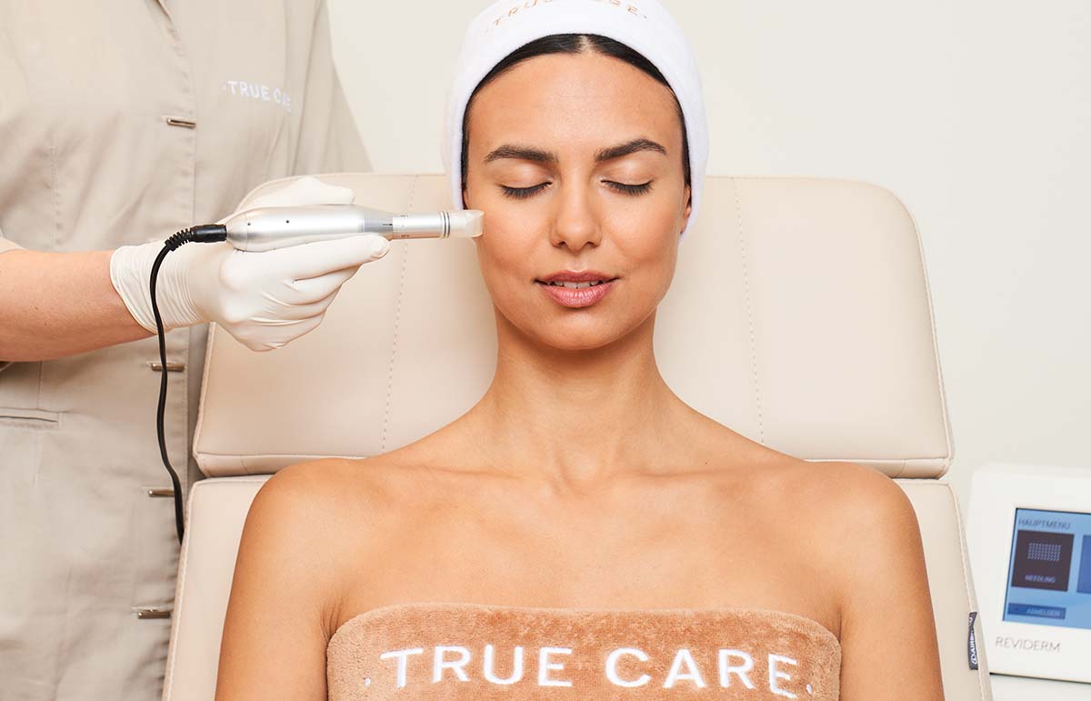 microneedling gesichtsbehandlung bei true care in münchen